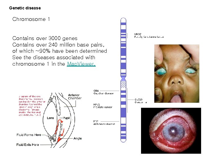 Genetic disease Chromosome 1 Contains over 3000 genes Contains over 240 million base pairs,