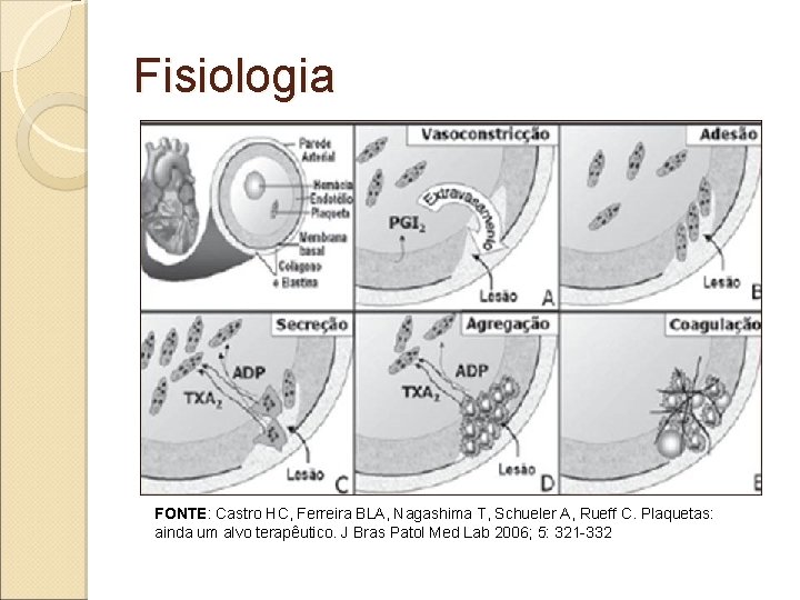 Fisiologia FONTE: Castro HC, Ferreira BLA, Nagashima T, Schueler A, Rueff C. Plaquetas: ainda