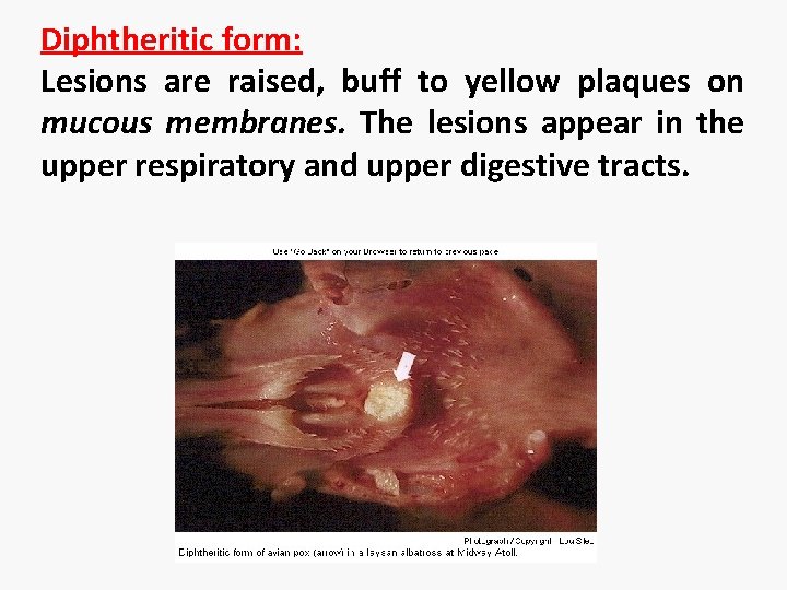 Diphtheritic form: Lesions are raised, buff to yellow plaques on mucous membranes. The lesions