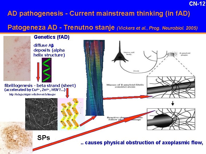 CN-12 AD pathogenesis - Current mainstream thinking (in f. AD) Patogeneza AD - Trenutno