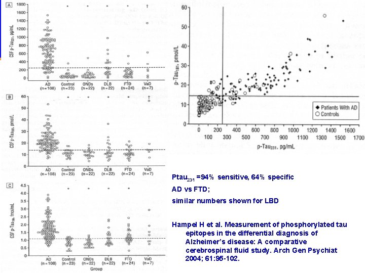 CN-22 Ptau 231 =94% sensitive, 64% specific AD vs FTD; similar numbers shown for