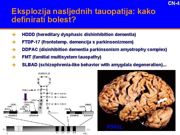 CN-4 Eksplozija nasljednih tauopatija: kako definirati bolest? è HDDD (hereditary dysphasic dishinhibition dementia) è