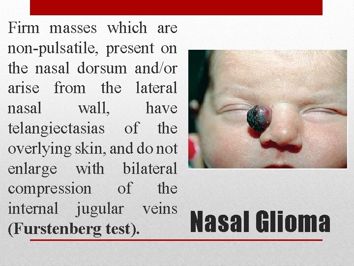 Firm masses which are non-pulsatile, present on the nasal dorsum and/or arise from the