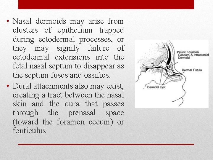  • Nasal dermoids may arise from clusters of epithelium trapped during ectodermal processes,