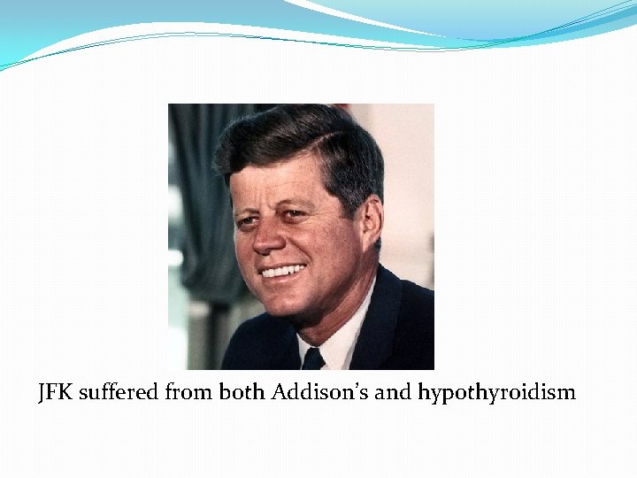 JFK suffered from both Addison’s and hypothyroidism 