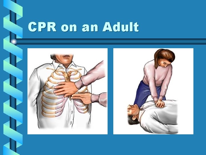 CPR on an Adult 