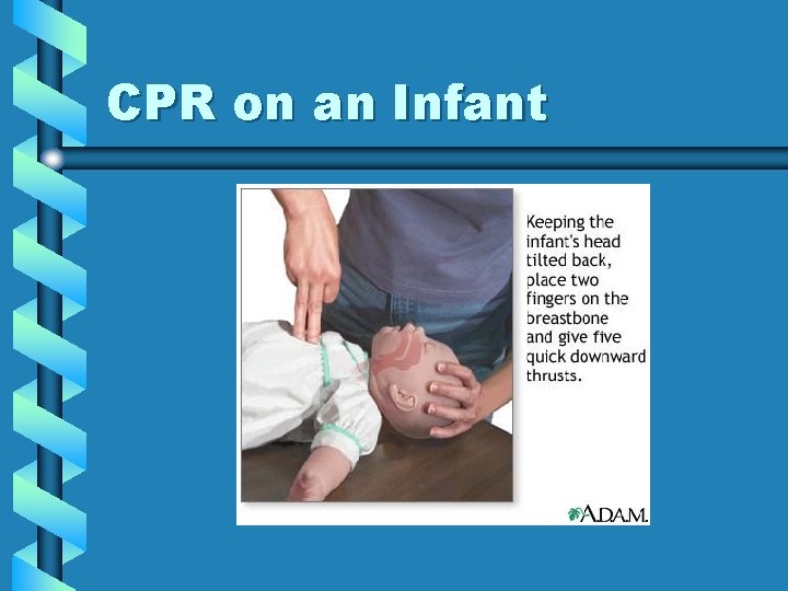 CPR on an Infant 