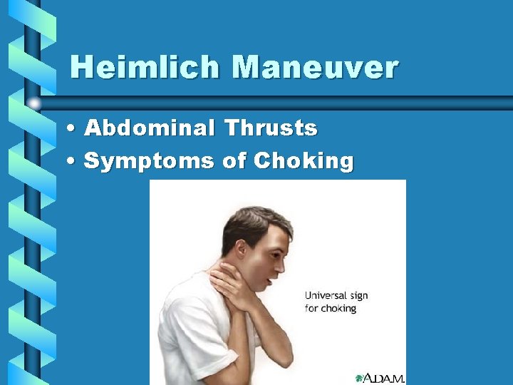 Heimlich Maneuver • Abdominal Thrusts • Symptoms of Choking 