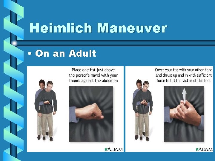 Heimlich Maneuver • On an Adult 