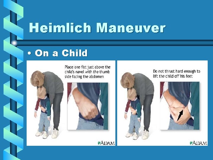 Heimlich Maneuver • On a Child 