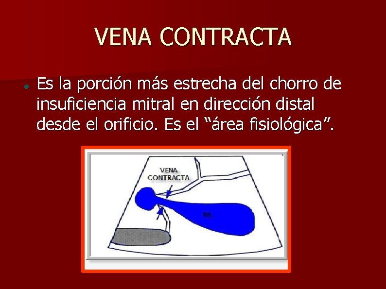 VENA CONTRACTA Es la porción más estrecha del chorro de insuficiencia mitral en dirección
