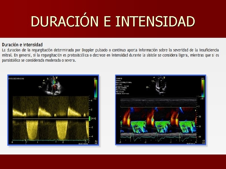 DURACIÓN E INTENSIDAD 