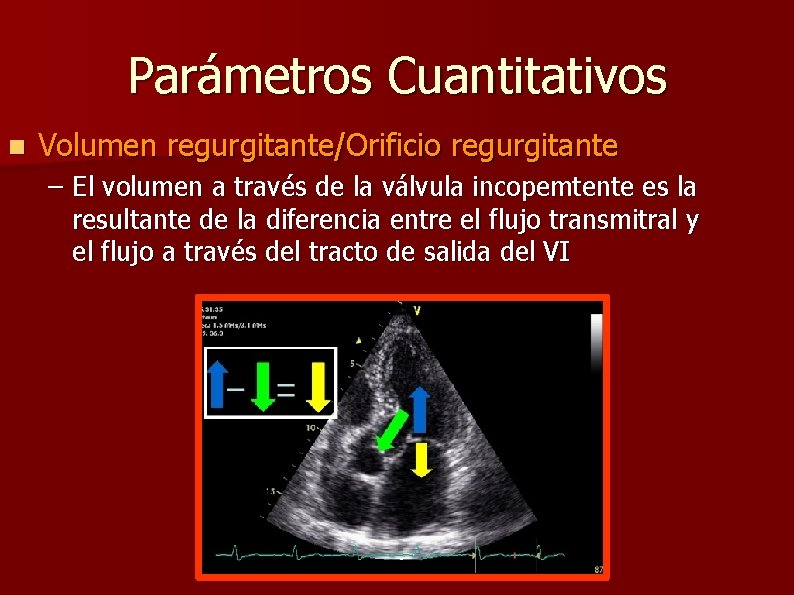 Parámetros Cuantitativos n Volumen regurgitante/Orificio regurgitante – El volumen a través de la válvula