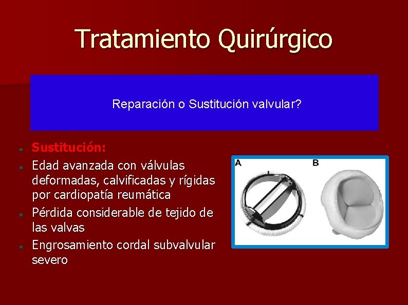 INSUFICIENCIA MITRAL PROLAPSO MITRAL Sergio Vsquez Ferreccio Crsitina