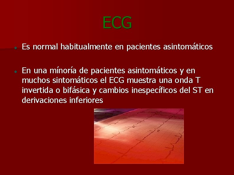 ECG Es normal habitualmente en pacientes asintomáticos En una mínoría de pacientes asintomáticos y