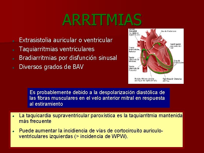 ARRITMIAS Extrasistolia auricular o ventricular Taquiarritmias ventriculares Bradiarritmias por disfunción sinusal Diversos grados de