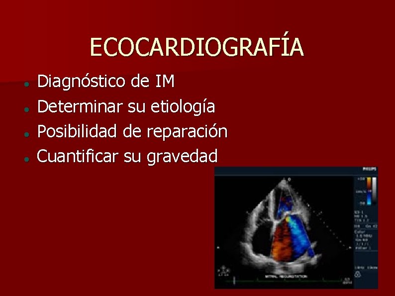 ECOCARDIOGRAFÍA Diagnóstico de IM Determinar su etiología Posibilidad de reparación Cuantificar su gravedad 