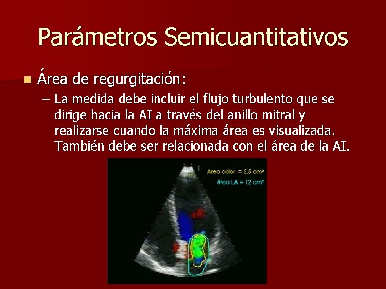 Parámetros Semicuantitativos n Área de regurgitación: – La medida debe incluir el flujo turbulento
