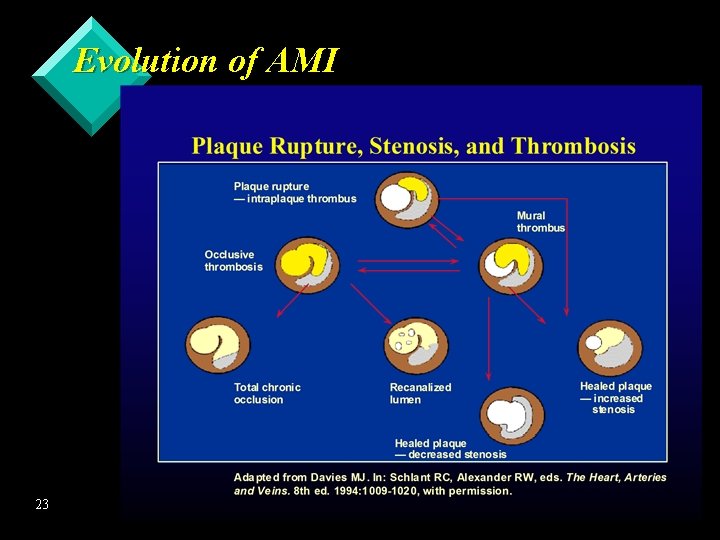 Evolution of AMI 23 