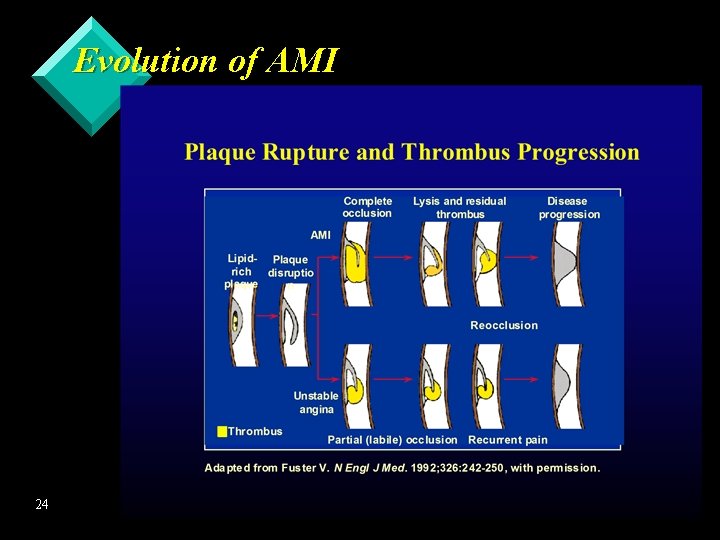 Evolution of AMI 24 