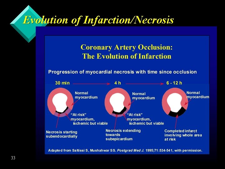 Evolution of Infarction/Necrosis 33 