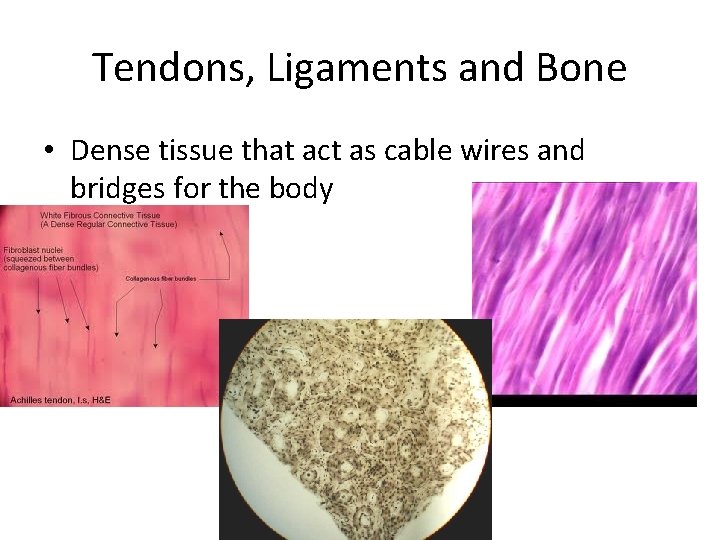 Tendons, Ligaments and Bone • Dense tissue that act as cable wires and bridges
