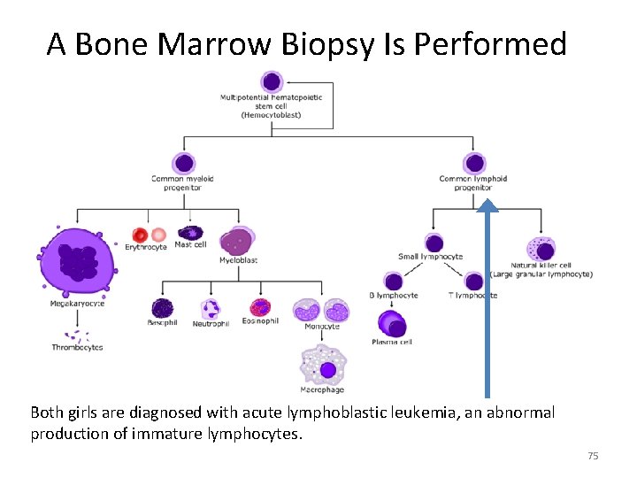 A Bone Marrow Biopsy Is Performed Both girls are diagnosed with acute lymphoblastic leukemia,