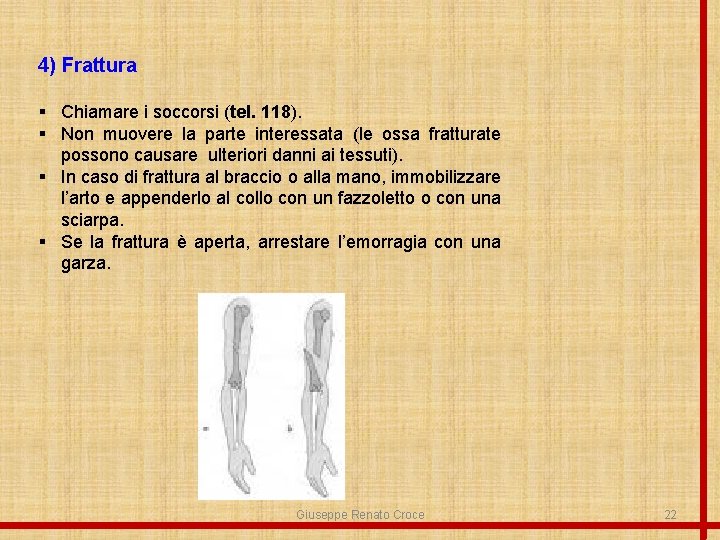 4) Frattura § Chiamare i soccorsi (tel. 118). § Non muovere la parte interessata