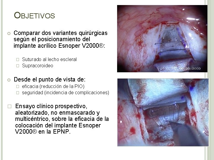OBJETIVOS Comparar dos variantes quirúrgicas según el posicionamiento del implante acrílico Esnoper V 2000®: