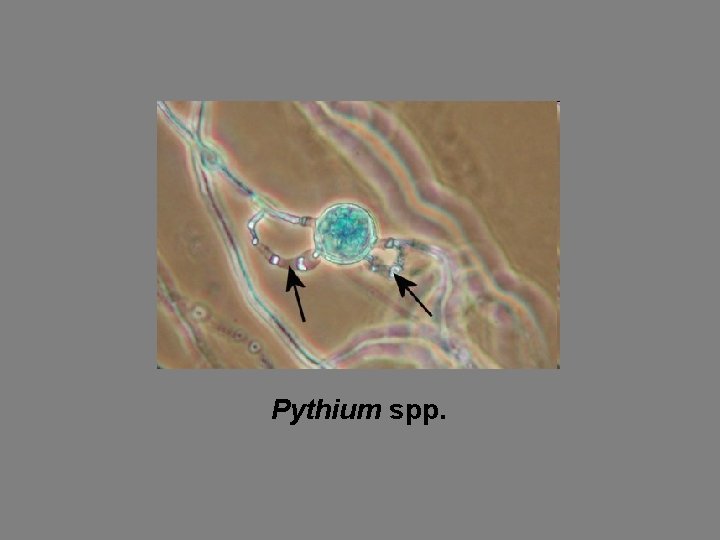 Pythium spp. 