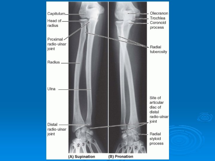 Bilaterally Upper Rails ARTICULATIONS OF UPPER EXTREMITY Pages 394 401 Articulations