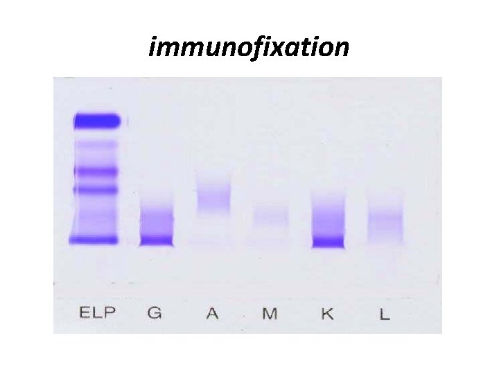 immunofixation 
