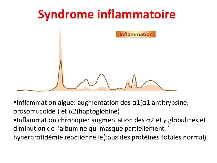 Syndrome inflammatoire §Inflammation aigue: augmentation des α 1(α 1 antitrypsine, orosomucoide ) et α