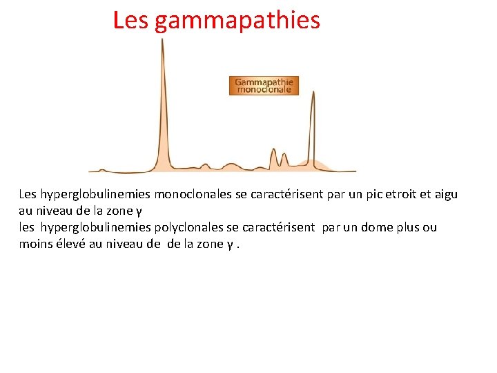 Les gammapathies Les hyperglobulinemies monoclonales se caractérisent par un pic etroit et aigu au