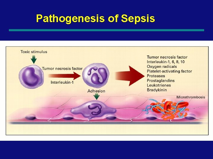 Pathogenesis of Sepsis 