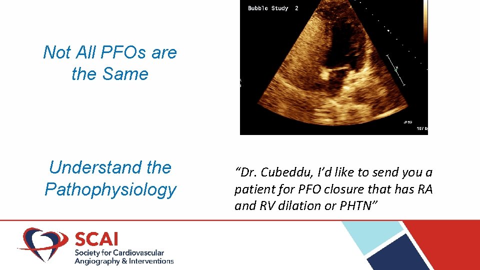 Not All PFOs are the Same Understand the Pathophysiology “Dr. Cubeddu, I’d like to