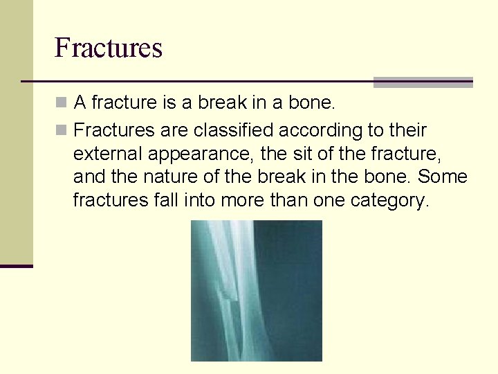 Fractures n A fracture is a break in a bone. n Fractures are classified