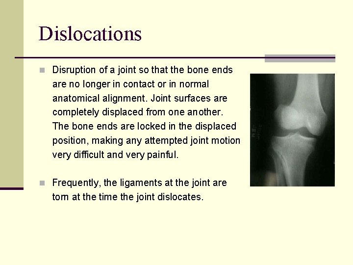 Dislocations n Disruption of a joint so that the bone ends are no longer