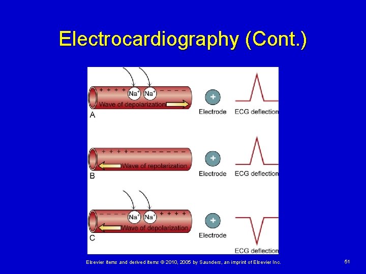 Electrocardiography (Cont. ) Elsevier items and derived items © 2010, 2005 by Saunders, an