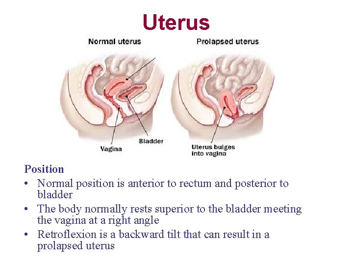 Uterus Position • Normal position is anterior to rectum and posterior to bladder •