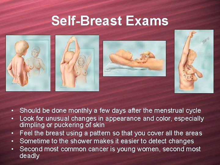 Self-Breast Exams • Should be done monthly a few days after the menstrual cycle