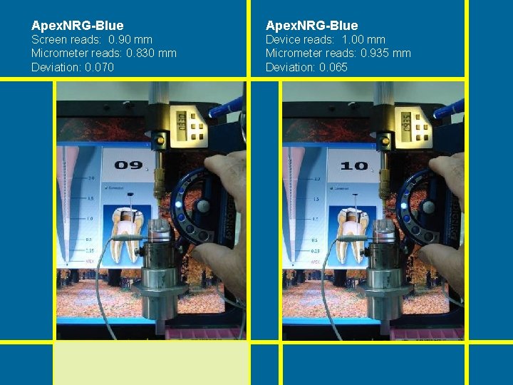 Apex. NRG-Blue Screen reads: 0. 90 mm Micrometer reads: 0. 830 mm Deviation: 0. Apex. NRG-Blue Screen reads: 0. 90 mm Micrometer reads: 0. 830 mm Deviation: 0.