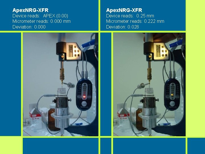 Apex. NRG-XFR Device reads: APEX (0. 00) Micrometer reads: 0. 000 mm Deviation: 0. Apex. NRG-XFR Device reads: APEX (0. 00) Micrometer reads: 0. 000 mm Deviation: 0.