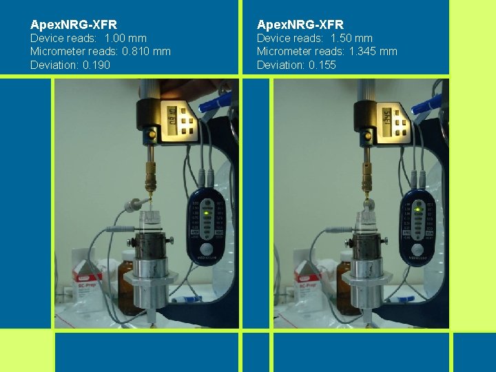 Apex. NRG-XFR Device reads: 1. 00 mm Micrometer reads: 0. 810 mm Deviation: 0. Apex. NRG-XFR Device reads: 1. 00 mm Micrometer reads: 0. 810 mm Deviation: 0.