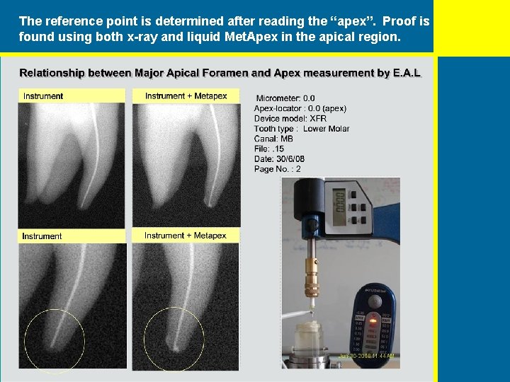 The reference point is determined after reading the “apex”. Proof is found using both The reference point is determined after reading the “apex”. Proof is found using both