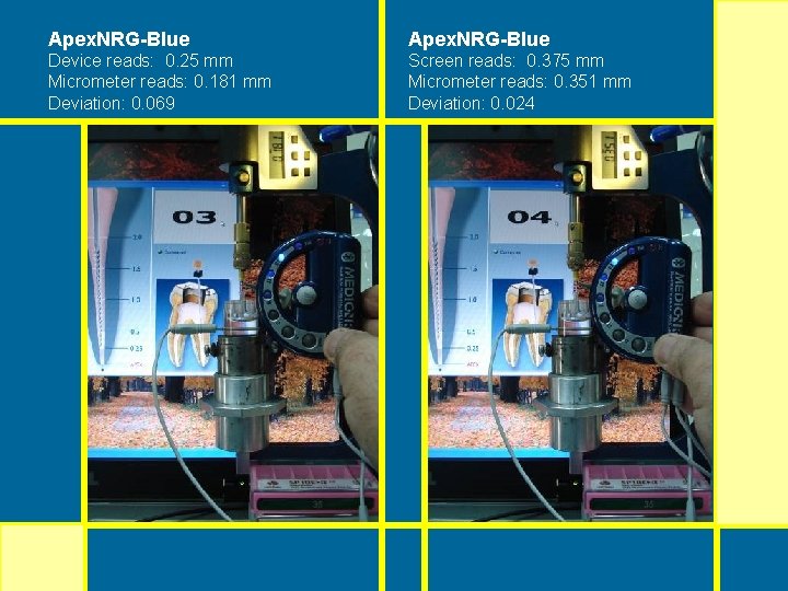 Apex. NRG-Blue Device reads: 0. 25 mm Micrometer reads: 0. 181 mm Deviation: 0. Apex. NRG-Blue Device reads: 0. 25 mm Micrometer reads: 0. 181 mm Deviation: 0.