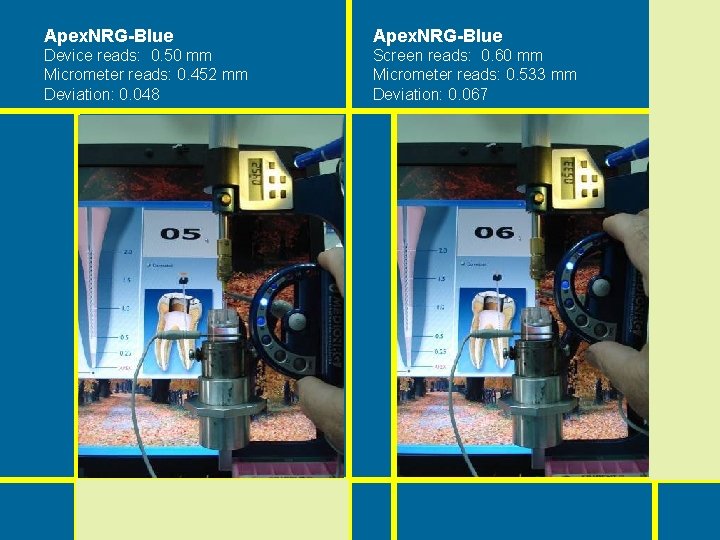 Apex. NRG-Blue Device reads: 0. 50 mm Micrometer reads: 0. 452 mm Deviation: 0. Apex. NRG-Blue Device reads: 0. 50 mm Micrometer reads: 0. 452 mm Deviation: 0.