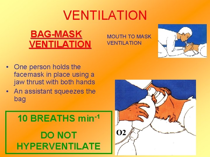VENTILATION BAG-MASK VENTILATION • One person holds the facemask in place using a jaw