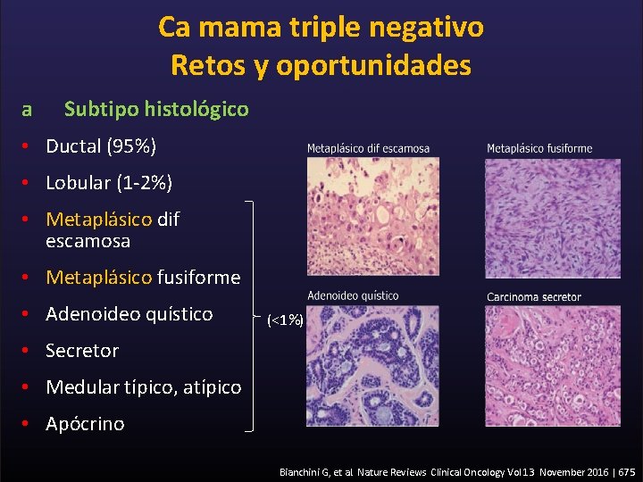 Ca mama triple negativo Retos y oportunidades a Subtipo histológico • Ductal (95%) •