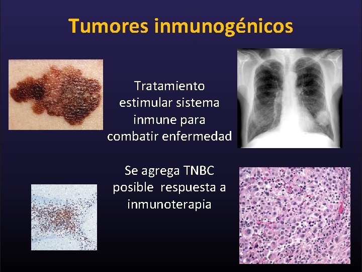 Tumores inmunogénicos Tratamiento estimular sistema inmune para combatir enfermedad Se agrega TNBC posible respuesta